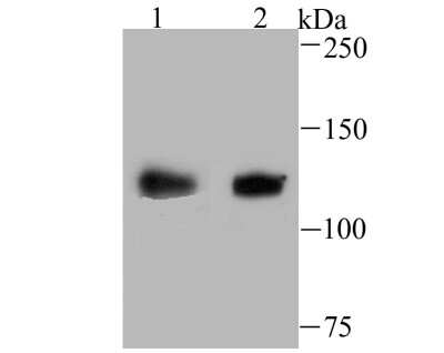 Western Blot: USP10 Antibody (JU32-62) [NBP2-75698] - Analysis of USP10 on SiHa (1) and A549 (2) cell lysate using anti-USP10 antibody at 1/500 dilution.