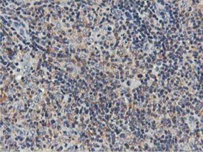 Immunohistochemistry: USP10 Antibody (OTI2E1) - Azide and BSA Free [NBP2-74798] - Staining of paraffin-embedded Human lymphoma tissue using anti-USP10 mouse monoclonal antibody.