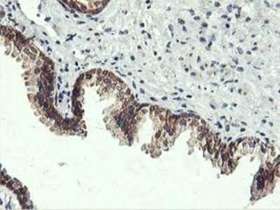 Immunohistochemistry: USP10 Antibody (OTI2E1) - Azide and BSA Free [NBP2-74798] - Staining of paraffin-embedded Human prostate tissue using anti-USP10 mouse monoclonal antibody.