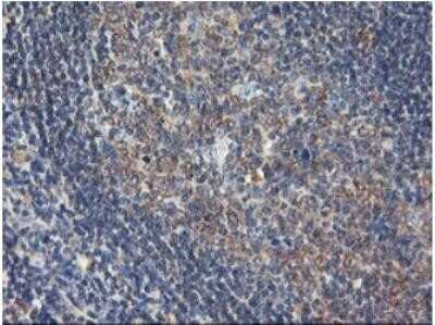 Immunohistochemistry: USP10 Antibody (OTI2E1) - Azide and BSA Free [NBP2-74798] - Immunohistochemical staining of paraffin-embedded Human tonsil within the normal limits using anti-USP10 mouse monoclonal antibody. (Heat-induced epitope retrieval by 10mM citric buffer, pH6.0, 100 degrees C for 10min, NBP2-01452)