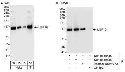 <b>Independent Antibodies Validation and Biological Strategies Validation.</b>Western Blot: USP10 Antibody [NB110-40545] - Detection of Human USP10 on HeLa whole cell lysate using NB110-40545. USP10 was also immunoprecipitated by another rabbit anti-USP10 antibody and NB110-40546.