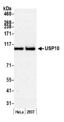 Western Blot: USP10 Antibody [NB110-40545] - Detection of human USP10 by western blot. Samples: Whole cell lysate (50 µg) from HeLa and HEK293T cells prepared using NETN lysis buffer. Antibody: Affinity purified rabbit anti-USP10 antibody NB110-40545 used for WB at 0.1 µg/ml. Detection: Chemiluminescence with an exposure time of 30 seconds.