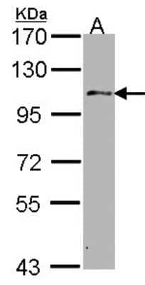 Western Blot: USP10 Antibody [NBP1-33677] - Sample (30 ug of whole cell lysate) A: Hep G2 7. 5% SDS PAGE; antibody diluted at 1:1000.