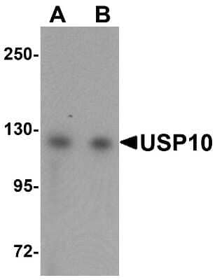 Western Blot: USP10 Antibody [NBP1-77170] - Jurkat cell lysate with USP10 antibody at (A) 1 and (B) 2 ug/mL.