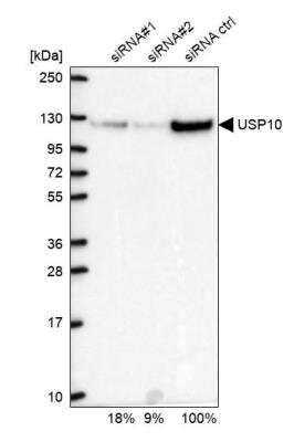 Western Blot: USP10 Antibody [NBP1-83029] - Analysis in U2OS cells transfected with control siRNA, target specific siRNA probe #1 and #2. Remaining relative intensity is presented.