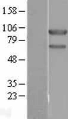 Western Blot: USP10 Overexpression Lysate (Adult Normal) [NBL1-17643] Left-Empty vector transfected control cell lysate (HEK293 cell lysate); Right -Over-expression Lysate for USP10.