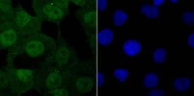 Immunocytochemistry/Immunofluorescence: USP11 Antibody (JM33-62) [NBP2-66771] - Staining USP11 in A549 cells (green). The nuclear counter stain is DAPI (blue). Cells were fixed in paraformaldehyde, permeabilised with 0.25% Triton X100/PBS.