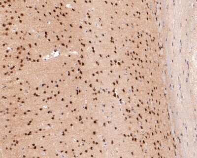 Immunohistochemistry-Paraffin: USP11 Antibody (JM33-62) [NBP2-66771] - Analysis of paraffin-embedded mouse brain tissue using anti-USP11 antibody. The section was pre-treated using heat mediated antigen retrieval with sodium citrate buffer (pH 6.0) for 20 minutes. The tissues were blocked in 1% BSA for 30 minutes at room temperature, washed with ddH2O and PBS, and then probed with the primary antibody (1/400) for 30 minutes at room temperature. The detection was performed using an HRP conjugated compact polymer system. DAB was used as the chromogen. Tissues were counterstained with hematoxylin and mounted with DPX.
