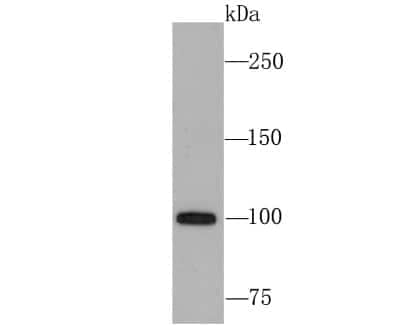 Western Blot: USP11 Antibody (JM33-62) [NBP2-66771] - Analysis of USP11 on 293T cell using anti-USP11 antibody at 1/1,000 dilution.
