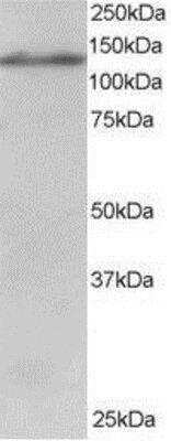 Western Blot: USP11 Antibody [NB100-1251] - (1ug/ml) of Jurkat lysate (RIPA buffer, 30ug total protein per lane). Primary incubated for 1 hour. Detected by western blot using chemiluminescence.