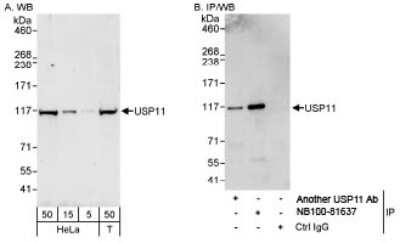 Western Blot: USP11 Antibody [NB100-81637] - Detection of Human USP11 on HeLa whole cell lysate using NB100-81637. USP11 was also immunoprecipitated by another rabbit anti-USP11 antibody.