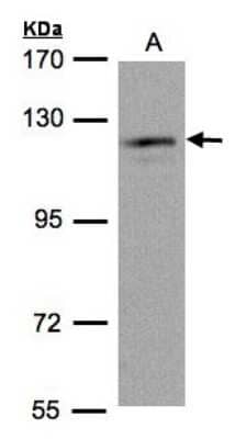 Western Blot: USP11 Antibody [NBP1-32810] - Sample(30 ug of whole cell lysate)A:HeLa S3 7. 5% SDS PAGE, antibody diluted at 1:1000.