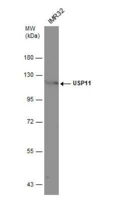 Western Blot: USP11 Antibody [NBP1-32810] - Whole cell extract (30 ug) was separated by 7.5% SDS-PAGE, and the membrane was blotted with USP11 antibody [N1N2], N-term diluted at 1:500.