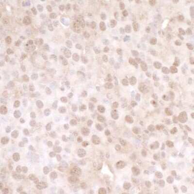 Immunohistochemistry-Paraffin: USP13 Antibody [NBP1-46203] - Detection of mouse USP13 by immunohistochemistry. Sample: FFPE section of mouse renal cell carcinoma. Antibody: Affinity purified rabbit anti-USP13 (NBP1-46203). Detection: DAB
