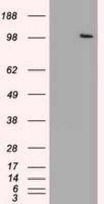 Western Blot: USP13 Antibody (OTI4G11) - Azide and BSA Free [NBP2-74802] - HEK293T cells were transfected with the pCMV6-ENTRY control (Left lane) or pCMV6-ENTRY USP13 (Right lane) cDNA for 48 hrs and lysed. Equivalent amounts of cell lysates (5 ug per lane) were separated by SDS-PAGE and immunoblotted with anti-USP13.