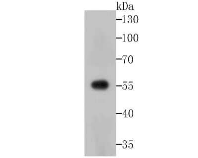 Western Blot: USP14 Antibody (JU30-49) [NBP2-75700] - Analysis of USP14 on Zebrafish tissue lysates using anti-USP14 antibody at 1/200 dilution.