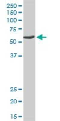 Western Blot: USP14 Antibody [H00009097-D01P] - Analysis of USP14 expression in human pancreas.