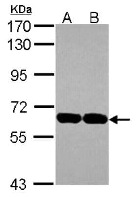 Western Blot: USP14 Antibody [NBP2-20825] - Sample (30 ug of whole cell lysate) A: A431 B: JurKat 7. 5% SDS PAGE gel, diluted at 1:1000.