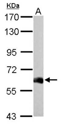 Western Blot: USP14 Antibody [NBP2-20825] - USP14 antibody detects USP14 protein by Western blot analysis. A. 50 ug mouse brain lysate/extract7. 5 % SDS-PAGEUSP14 antibody dilution: 1:1000.