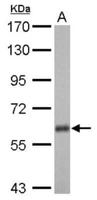 Western Blot: USP14 Antibody [NBP2-20825] - USP14 antibody detects USP14 protein by Western blot analysis. A. 50 ug rat brain lysate/extract7. 5 % SDS-PAGEUSP14 antibody dilution: 1:1000.