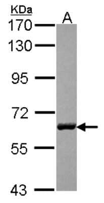 Western Blot: USP14 Antibody [NBP2-20826] - Sample (30 ug of whole cell lysate) A: A431 7. 5% SDS PAGE gel, diluted at 1:1000.