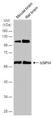 Western Blot: USP14 Antibody [NBP2-20826] -  Various tissue extracts (50 ug) were separated by 10% SDS-PAGE, and the membrane was blotted with USP14 antibody diluted at 1:1000. The HRP-conjugated anti-rabbit IgG antibody (NBP2-19301) was used to detect the primary antibody.