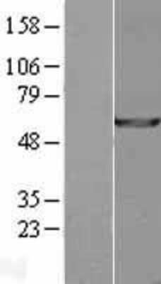 Western Blot: USP14 Overexpression Lysate (Adult Normal) [NBL1-17646] Left-Empty vector transfected control cell lysate (HEK293 cell lysate); Right -Over-expression Lysate for USP14.