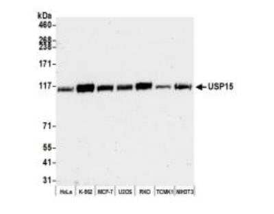 <b>Genetic Strategies Validation. </b>Western Blot: USP15 Antibody [NB110-40690] -  Whole cell lysate (50 ug) from HeLa, K-562, MCF-7, U2OS, RKO, TCMK-1, and NIH 3T3 cells prepared using NETN lysis buffer. Antibody: Affinity purified rabbitanti-USP15 antibody used for WB at 0.1 ug/ml. Detection: Chemiluminescence withan exposure time of 30 seconds.