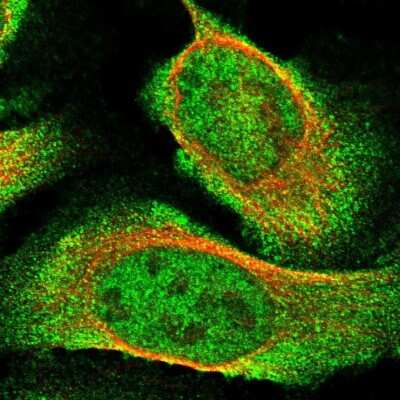 Immunocytochemistry/ Immunofluorescence USP16 Antibody - BSA Free