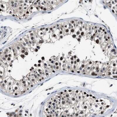 Immunohistochemistry-Paraffin USP16 Antibody - BSA Free