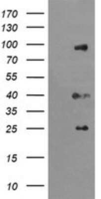 Western Blot: USP16 Antibody (OTI1B4) - Azide and BSA Free [NBP2-74805] - E.coli lysate (5 ug, left lane) and E.coli lysate expressing human recombinant protein fragment (5 ug, right lane) corresponding to amino acids 137-466 of human USP16(NP_001001992) were separated by SDS-PAGE and immunoblotted with USP16.