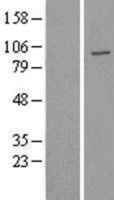 Western Blot USP16 Overexpression Lysate