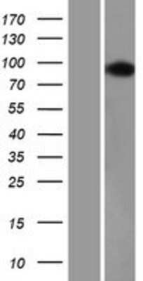Western Blot USP16 Overexpression Lysate
