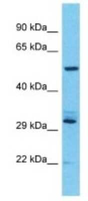 Western Blot: USP17L7 Antibody [NBP3-09905] - Western blot analysis of USP17L7 in NCI-H226 Whole Cell lysates. Antibody dilution at 1.0ug/ml