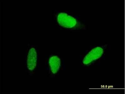 Immunocytochemistry/Immunofluorescence: USP18 Antibody [H00011274-B02P] - Analysis of purified antibody to USP18 on HeLa cell. (antibody concentration 10 ug/ml)