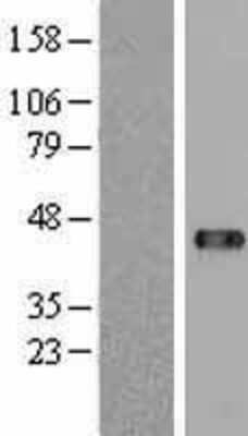 Western Blot: USP18 Overexpression Lysate (Adult Normal) [NBL1-17648] Left-Empty vector transfected control cell lysate (HEK293 cell lysate); Right -Over-expression Lysate for USP18.