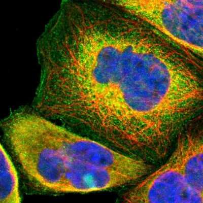 Immunocytochemistry/Immunofluorescence: USP2 Antibody [NBP1-86883] - Immunofluorescent staining of human cell line A-431 shows localization to plasma membrane & cytosol. Antibody staining is shown in green.