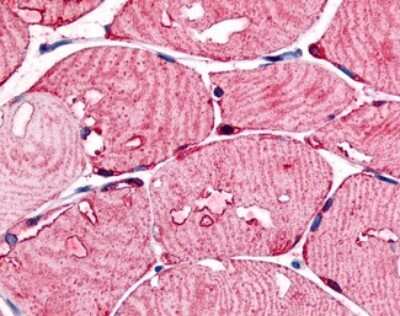 Immunohistochemistry-Paraffin: USP2 Antibody [NB110-40473] - Analysis of anti-USP2 antibody with human skeletal muscle.
