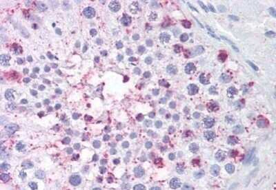 Immunohistochemistry-Paraffin: USP2 Antibody [NB110-83975] - Analysis of anti-USP2 antibody with human testis at concentration 5 ug/ml.