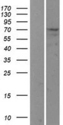 Western Blot USP2 Overexpression Lysate