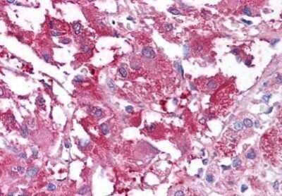 Immunohistochemistry-Paraffin: USP20 Antibody [NB100-59027] - Analysis of anti-USP20 antibody with human adrenal medulla at concentration 10 ug/ml.