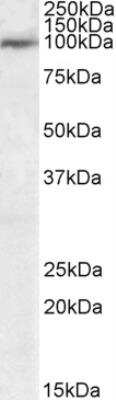 Western Blot USP20 Antibody