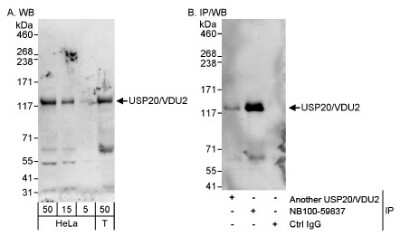 Western Blot USP20 Antibody - BSA Free