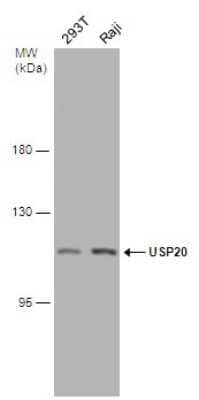 Western Blot: USP20 Antibody [NBP3-13080] - Various whole cell extracts (60 ug) were separated by 7.5% SDS-PAGE, and the membrane was blotted with USP20 antibody (NBP3-13080) diluted at 1:1000.