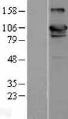 Western Blot USP20 Overexpression Lysate