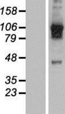 Western Blot USP20 Overexpression Lysate