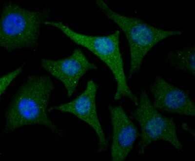 Immunocytochemistry/Immunofluorescence: USP21 Antibody [NBP2-75701] - Staining USP21 in SH-SY-5Y cells (green). The nuclear counter stain is DAPI (blue). Cells were fixed in paraformaldehyde, permeabilised with 0.25% Triton X100/PBS.
