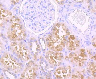 Immunohistochemistry-Paraffin: USP21 Antibody [NBP2-75701] - Analysis of paraffin-embedded human kidney tissue using anti-USP21 antibody. Counter stained with hematoxylin.