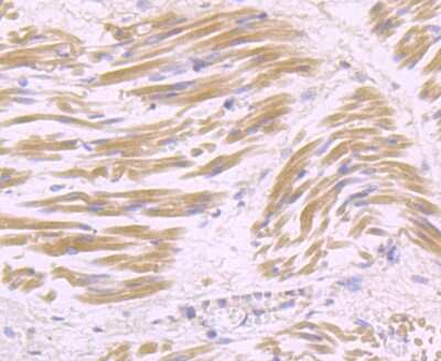 Immunohistochemistry-Paraffin: USP21 Antibody [NBP2-75701] - Analysis of paraffin-embedded human fetal skeletal muscle tissue using anti-USP21 antibody. Counter stained with hematoxylin.