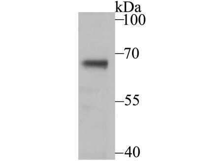 Western Blot: USP21 Antibody [NBP2-75701] - Analysis of USP21 on mouse thymus tissue lysate using anti-USP21 antibody at 1/200 dilution.
